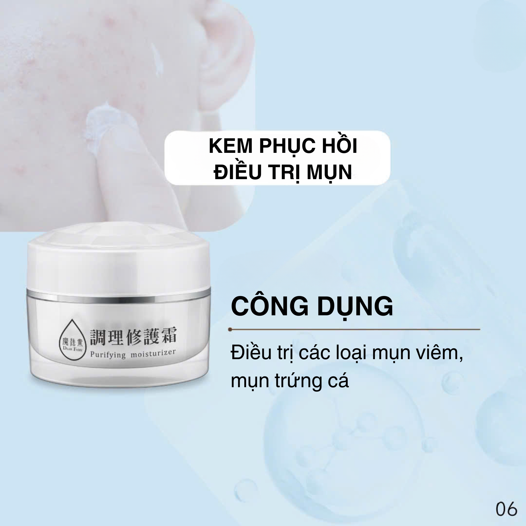 Kem phục hồi trị mụn
